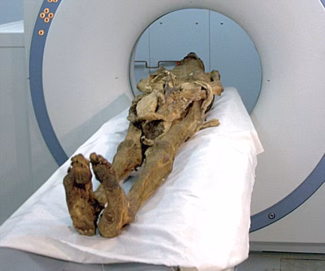 Một số giả thuyết được đưa ra để lý giải cái chết của người đàn ông trên. Theo đó, giả thuyết phố biến được nhiều người biết đến là "xác ướp la hét" được cho thuộc về Hoàng tử Pentewere.