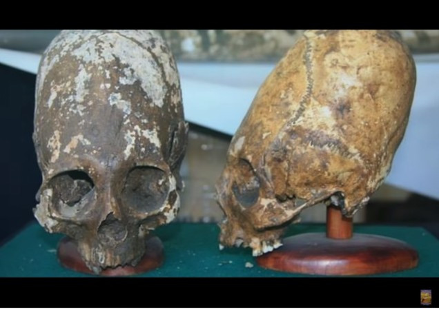 Vì vậy, cho đến nay, các chuyên gia, nhà khoa học mãi vẫn chưa thể giải mã được bí ẩn về những hộp sọ Paracas nằm ở đâu trong sơ đồ tiến hóa của loài người.