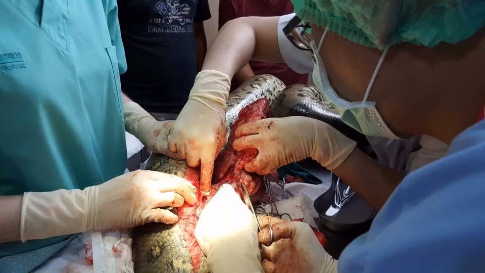 Cuộc đại phẫu thuật của trăn khổng lồ Keow mất tới 7 tiếng đồng hồ liên tục. Cuối cùng, các bác sĩ cũng bóc tách khối u cho Keow thành công. (Nguồn Sina)