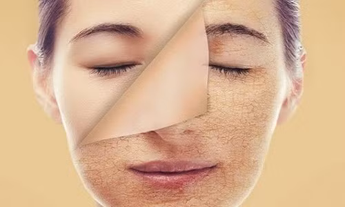 10. Đa số bụi bẩn trong nhà của bạn là da chết trên cơ thể con người.