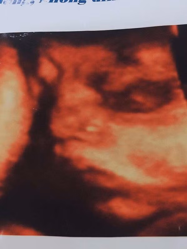 Hình ảnh con anh L. siêu âm trước khi mất. Ảnh gia đình cung cấp.