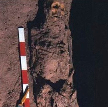 Trong khi đó, hài cốt một người phụ nữ lớn tuổi có dấu hiệu mắc ung thư buồng trứng hoặc ung thư vú.