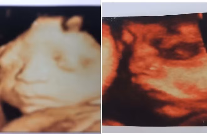 Chồng quẫn trí tự tử vì mất 2 con ở Bắc Giang, bạn thân đi cùng vợ cho biết thai nhi bị chết lưu khoảng 2 tuần trước khi người vợ thông báo mất con