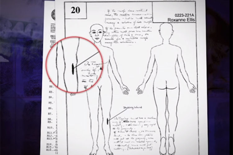 Một vết cắt xuất hiện dưới đầu gối chân trái của Roxanne, gần vị trí kẻ sát nhân trói cô bằng băng dính. Vị trí vết cắt cho thấy hung thủ trói chân người phụ nữ bằng băng dính trong căn hộ, nhưng hắn dùng dao cắt băng dính để cô có thể bước lên xe.