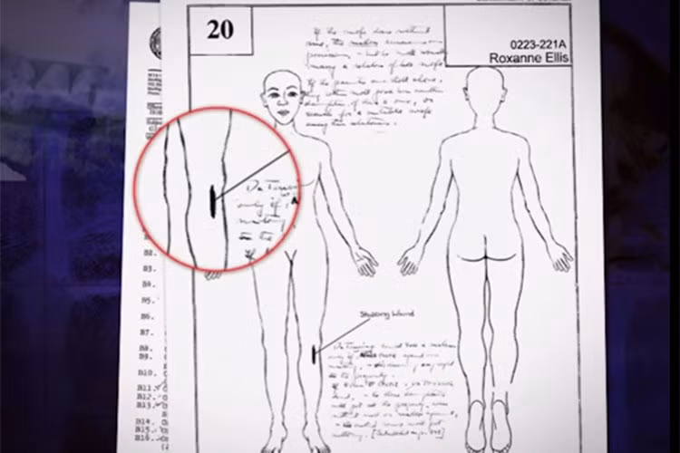Một vết cắt xuất hiện dưới đầu gối chân trái của Roxanne, gần vị trí kẻ sát nhân trói cô bằng băng dính. Vị trí vết cắt cho thấy hung thủ trói chân người phụ nữ bằng băng dính trong căn hộ, nhưng hắn dùng dao cắt băng dính để cô có thể bước lên xe.