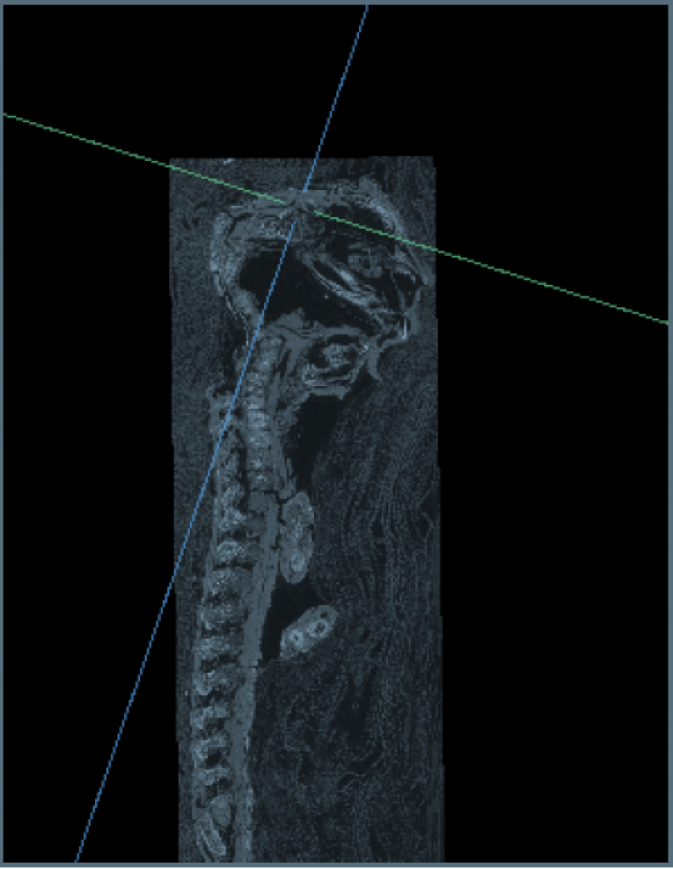 Lớp vỏ bọc ngoài xác ướp bé trai này còn được in hình Osiris – vị thần của cái chết, cai quản thế giới bên kia của Ai Cập, nằm trên khung một cỗ áo quan còn gọi là kiệu khiêng quan tài, cùng với nữ thần Iris và Nephthys đứng cạnh.