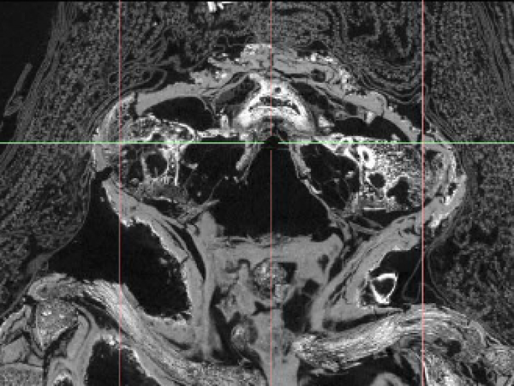 Các chuyên gia suy đoán dường như xác của đứa bé trai đã được ướp rất cẩn thận.