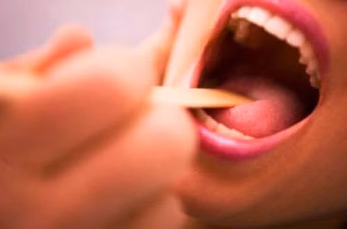  Ung thư hầu, miệng. Theo nhiều nghiên cứu khoa học cho thấy những người thường xuyên hút thuốc lá có nguy cơ mắc bệnh ung thư khoang miệng cao gấp 27 lần so với những người không hút thuốc, không tiếp xúc với môi trường có nhiều khói thuốc. Các dẫn chất trong thuốc lá và khói thuốc lá có chứa các chất thúc đẩy sự phát triển ung thư trong khoang miệng.