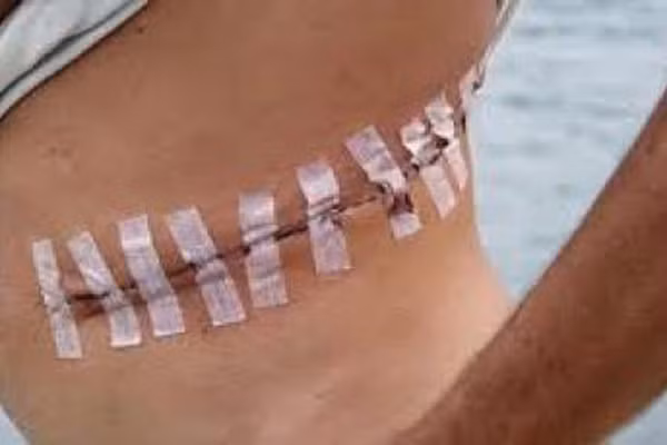 Theo tiết lộ của nhà báo Scott Carney, người nghiên cứu và viết một cuốn sách về thị trường chợ đen, sau trận động đất năm 2004, ở Ấn Độ có một ngôi làng chuyên bán thận để có tiền tồn tại. Số lượng thận bất hợp pháp này nhằm phục vụ giới giàu có.