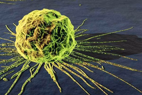 Nơi ở. Nên thuê một phòng gần bệnh viện hay trong khuôn viên bệnh viện để thuận lợi cho việc điều trị ung thư. Nếu bệnh nhân ung thư là trẻ em thì nhất thiết phải có người chăm sóc thường trực.