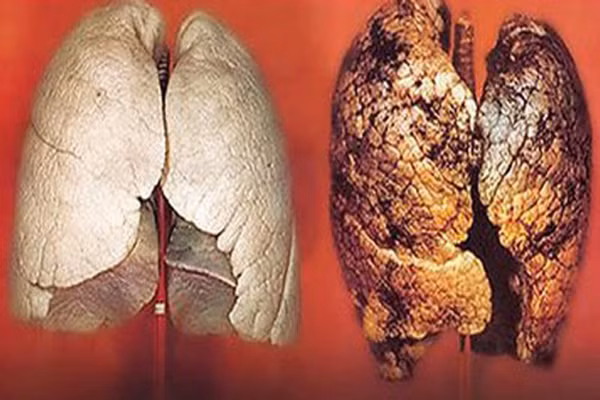 Khí Radon là một loại khí trơ, về mặt hóa học mà là một sản phẩm phân rã tự nhiên của uranium, sinh ra từ sự phân rã phóng xạ của uranium. Khí radon là nguyên nhân gây bệnh ung thư phổi, với khoảng 12% số ca tử vong. Loại khí này có ở hầu khắp mọi nơi trong lớp vỏ trái đất, thoát qua các vết rạn và lỗ trống rất nhỏ trong mặt đất, rồi khuếch tán vào không khí.