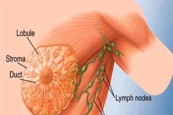 Phụ nữ dùng chất kích thích rượu bia nhiều. Mặc dù nó không thể loại bỏ hoàn toàn loại ung thư vú nhưng nếu phát hiện sớm sẽ giúp bạn biết điều chỉnh lối sống, sinh hoạt, chế độ ăn uống... để giảm thiểu mức độ bệnh và sống lâu hơn và khỏe mạnh hơn. Nếu bạn hút thuốc và uống rượu, hãy từ bỏ càng sớm càng tốt. Bên cạnh đó, bạn cần thường xuyên thể dục phù hợp sức khỏe. Ngay từ ở giai đoạn đầu, nếu có biện pháp phòng ngừa thích hợp, rủi ro phát bệnh của bạn sẽ giảm đáng kể dù nó có di truyền hay không.
