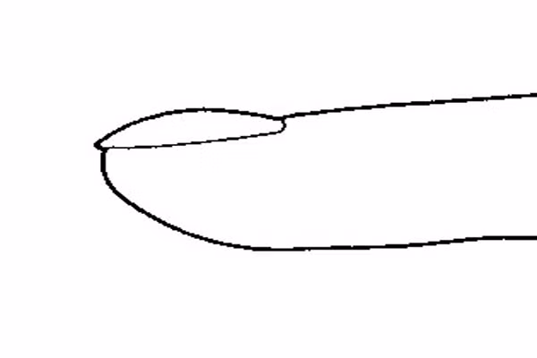 Móng tay cong. Tình trạng móng tay này tức là cơ thể bạn có ít các tế bào hồng cầu do thiếu sắt hoặc có thể bạn bị bệnh Raynaud, ảnh hưởng đến cung cấp máu cho các ngón tay và ngón chân khiến chúng chuyển sang màu trắng.