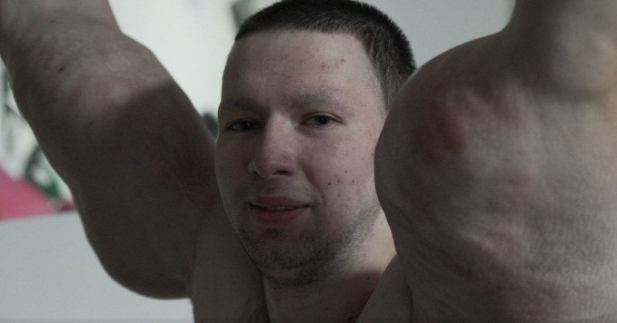 Sau đó, để có cơ bắp cường tráng như mình mong muốn, Kirill đã tự tiêm vào hai bắp tay mình khoảng 6 lít dầu tổng hợp.