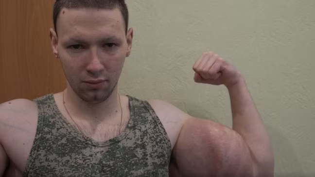 Cả cánh tay của Kirill sưng lên và luôn trong nhiệt độ hơn 38 độ. Kirill cũng bị viêm cơ và rất khó chịu.