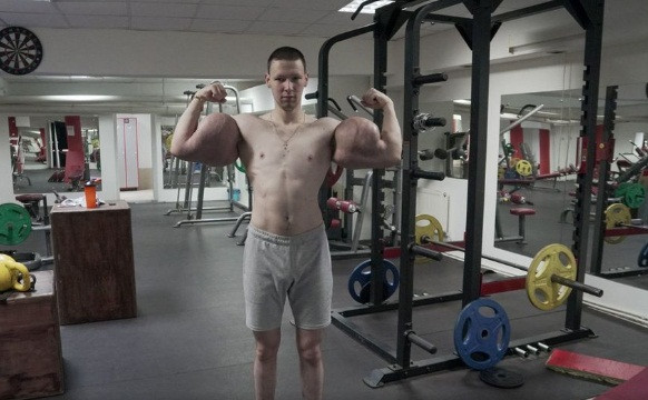 Mặc dù những lần tiêm sau bớt đau hơn và tình trạng khó chịu giảm xuống thế nhưng những cơn đau luôn quay lại.