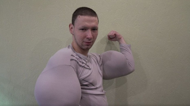 Tuy thế, chàng trẻ rất hạnh phúc vì hiện tại, anh chàng đã sở hữu bắp tay khủng có đường kính lên đến 61cm, bất chấp việc tiêm chất lạ vào cơ thể có thể gây ra những hậu quả khôn lường cho sức khỏe và tính mạng.