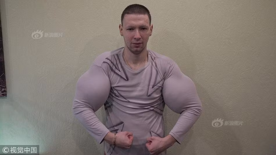 "Tôi đã đến phòng tập thể dục và luyện tập trong vòng 2 năm. Tôi ăn sáu lần một ngày và tập rất đều đặn. Mặc dù kiên trì và vất vả như thế nhưng kết quả rất chậm, không như ý. Tôi muốn quá trình trở nên mạnh mẽ phải nhanh hơn, tôi muốn những cơ bắp thật lớn", Kirill cho biết.