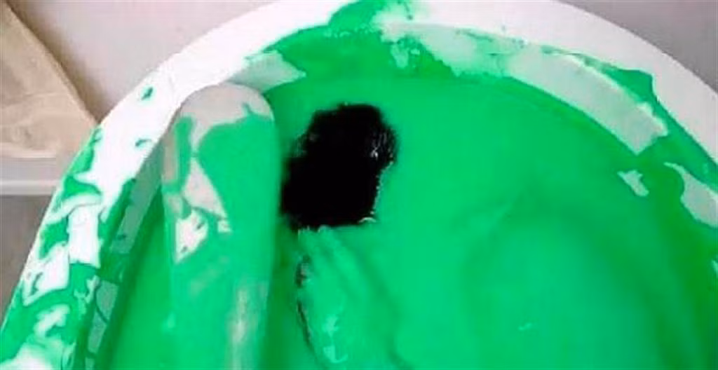 Chuyen la hom nay: Thanh nien tam son, lanh bi kich chi vi...-Hinh-3