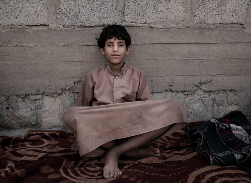 Morsal, một đứa trẻ khác tại trại Marib, kể lại mình đang đi đá bóng thì bị những người Houthi bắt đi lính. Thính giác của cậu bé bị ảnh hưởng nghiêm trọng bởi các vụ nổ và công kích trong cuộc chiến tranh. Ảnh: AP.