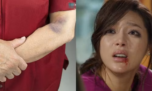 Vợ cứ tắm cho mẹ xong là người bà bầm tím Vo cu tam cho me xong la nguoi ba bam tim