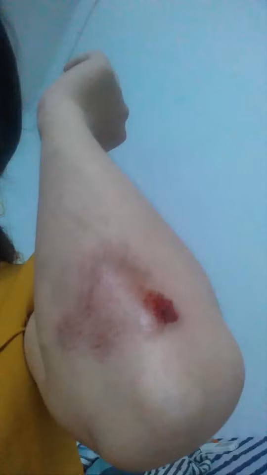 Va cham giao thong, thanh nien di SH hung ho xo nga ba bau-Hinh-3