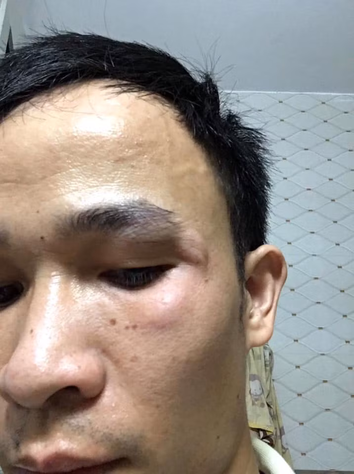 Cong an vao cuoc vu thanh nien di SH lao trung ba bau-Hinh-2