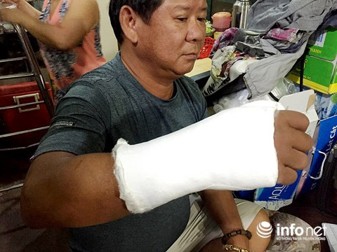 Ông Phong bị nhóm người lạ mặt đánh gãy tay phải.