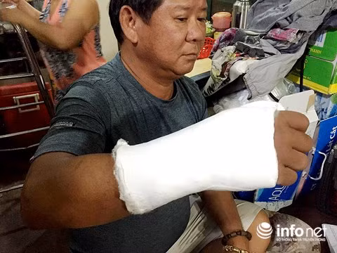 Ông Phong bị nhóm người lạ mặt đánh gãy tay phải.