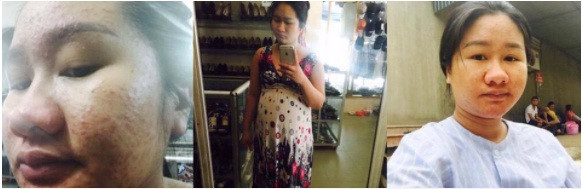 Tam su cua hot girl xinh dep bong 