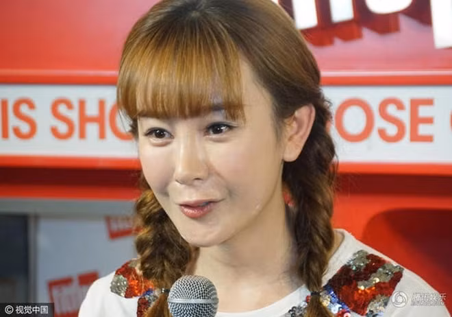 Gương mặt già nua, ngũ quan không cân xứng của Trương Mông sau phẫu thuật thẩm mỹ.