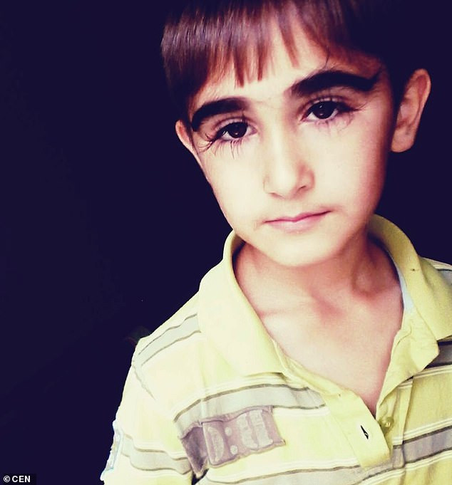 Cau be so huu hang mi cong vut, dai 4,3 cm khien chi em 