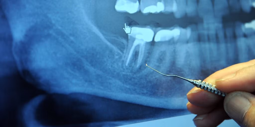 Bác sĩ chỉnh hình răng Lương trung bình năm: 228.780 USD Tăng trưởng việc làm dự báo (2016-2026): 17,3%.