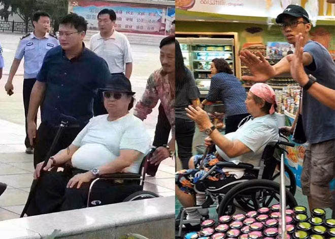 Việc nặng tới hơn 90kg khiến đầu gối của Hồng kim Bảo phải chống đỡ sức nặng quá lớn, cộng với những vết thương cũ nên bị tổn thương nghiêm trọng.