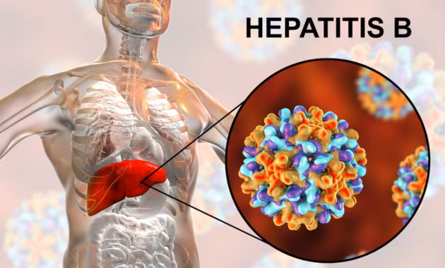 Cach nhan biet trieu chung virus viem gan co the gay tu vong