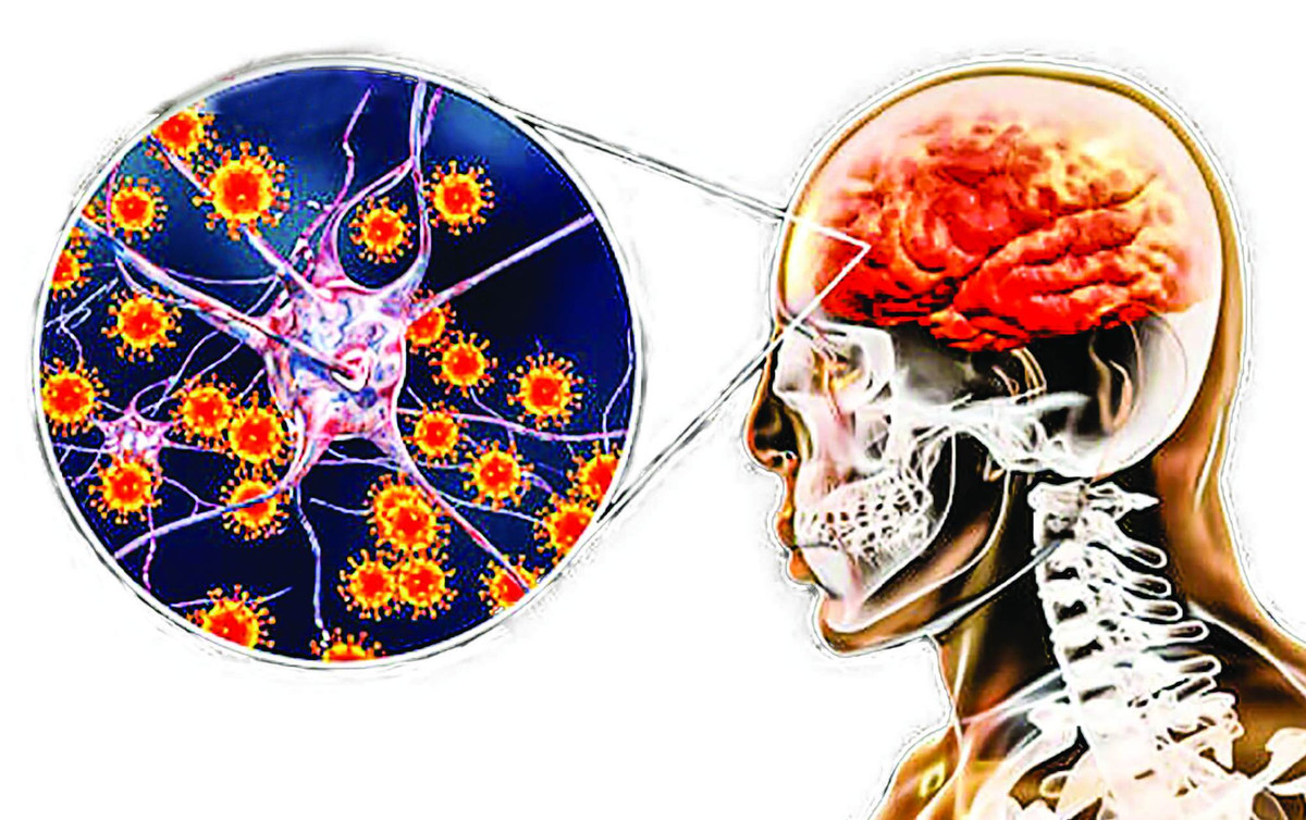 Viem nao Nhat Ban chua co thuoc dac tri: Phong benh the nao?