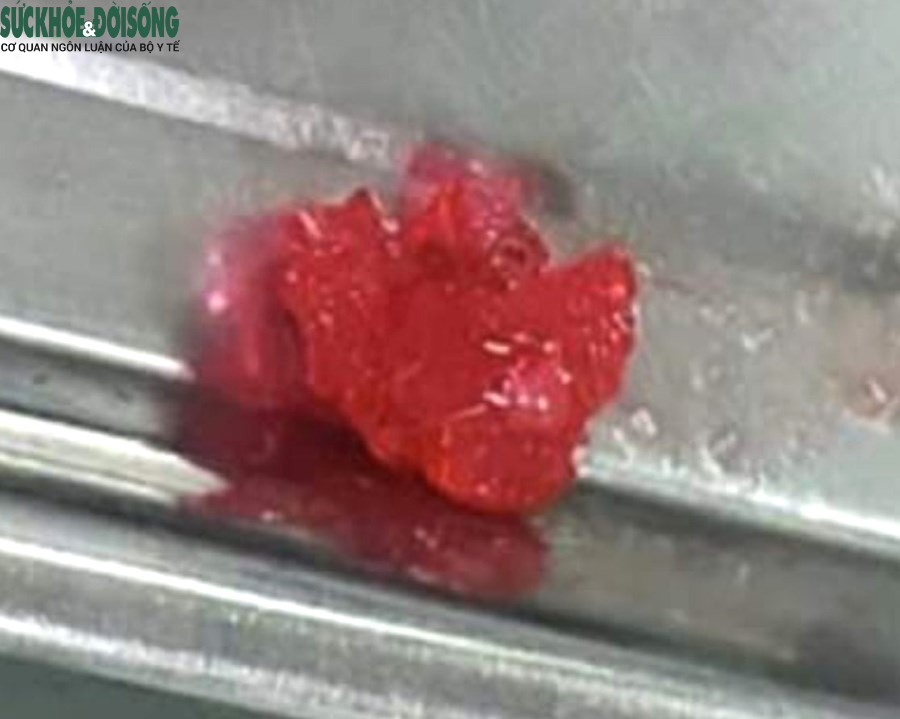 Nguyen tac vang cuu tre hoc keo deo, di vat tranh tu vong