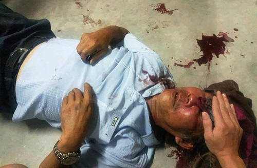 Ông Quang thời điểm bị bảo vệ đánh tàn nhẫn