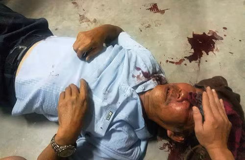 Ông Quang thời điểm bị bảo vệ đánh tàn nhẫn