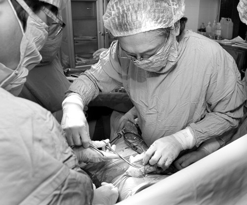 Ung thu co tu cung nen mo hay hoa xa tri