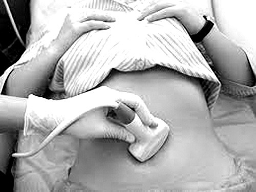 U buong trung 2 ben song duoc bao lau