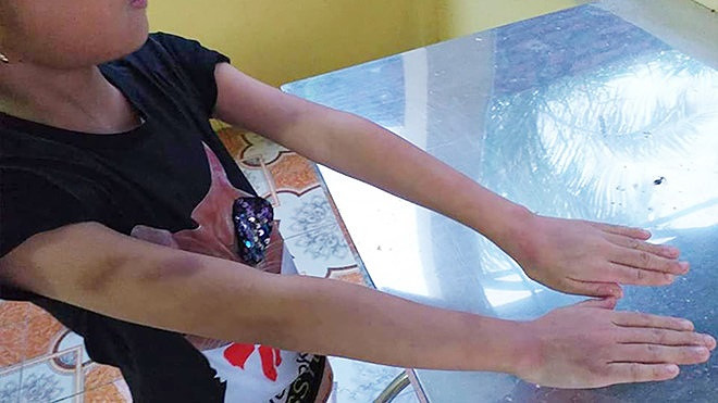 Mo lop hoc trai phep, co giao danh bam tim hoc sinh noi ngong va hay quen