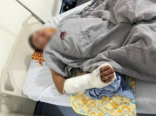 Hà Nội: 2 người bị chém trọng thương ở quán gội đầu Ha Noi: 2 nguoi bi chem trong thuong o quan goi dau