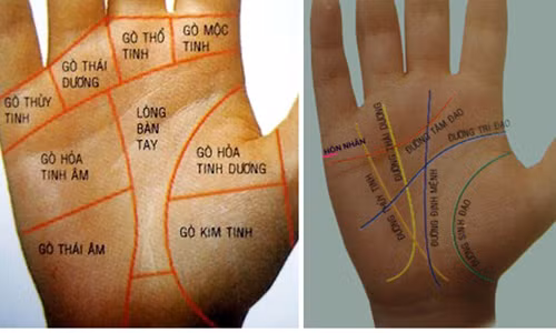 Not ruoi o vi tri nao tren ban tay la dai phu quy?