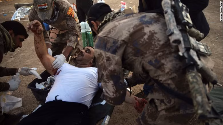 Binh sĩ Iraq chữa trị cho một dân thường bị thương do trúng đạn súng cối tại một bệnh viện dã chiến ở thành phố Mosul ngày 19/11.