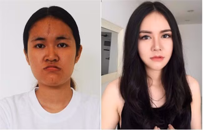 Nhan sắc quá khứ của cô gái thiếu may mắn được miêu tả: làn da đen nhẻm, khuôn mặt kém sắc, khớp hàm ngược, vẻ mặt lúc nào cũng như đang tức giận.