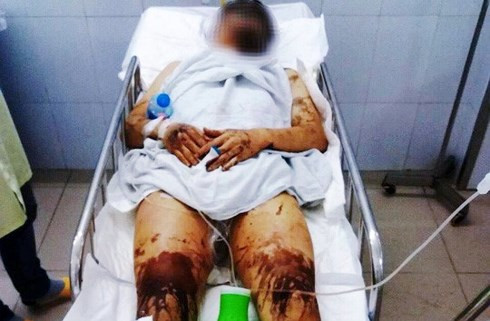 Doc gi hom nay 15/2: Giet vo moi cuoi roi nho ban than den xem chet chua-Hinh-3