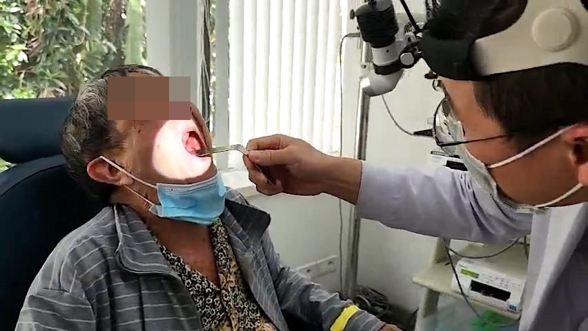 Cu ba 79 tuoi 2 nam chi nuot chao loang vi u xuong chen kin mieng