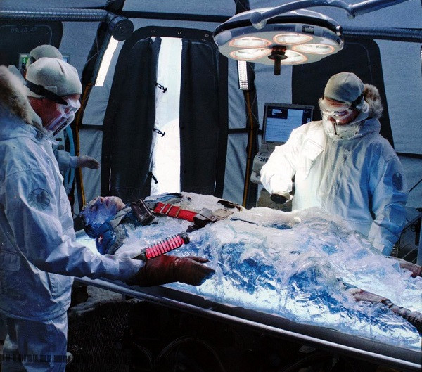 Sau 6 tieng co the dong bang vi lanh, co gai hoi sinh than ky-Hinh-5