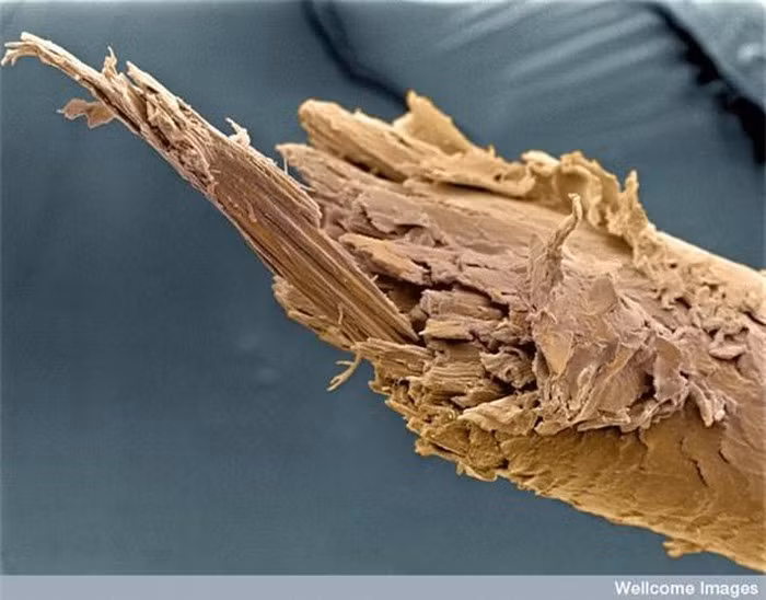 Khó mà tin rằng thứ tưởng chừng như thanh gỗ mục này lại là một sợi tóc hư tổn được zoom cận cảnh.